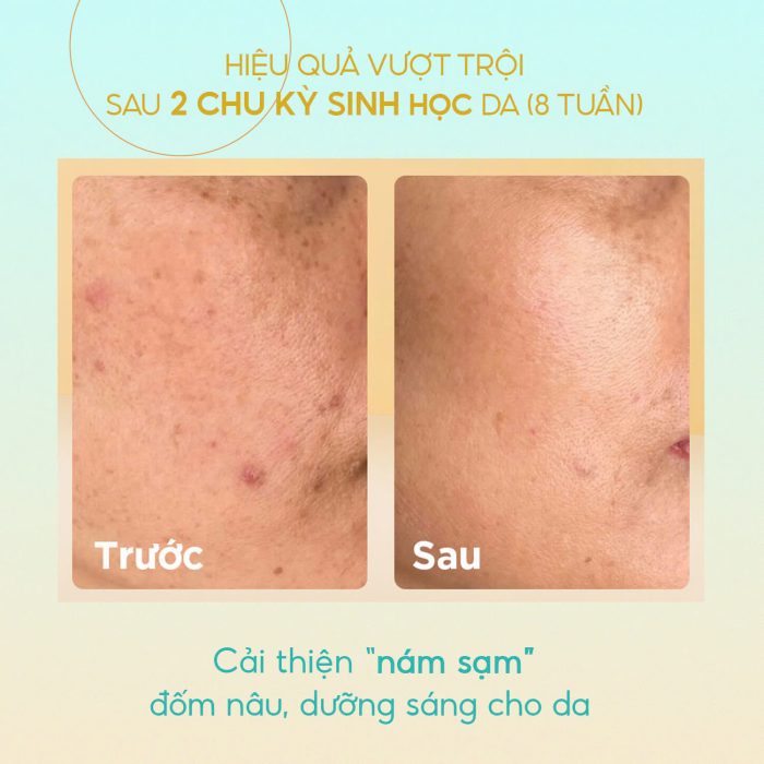 Tinh Chất Dưỡng Trắng Cấp Ẩm Làm Mờ Thâm Sạm Cho Bà Bầu GUO Radiance 4X Ampoule 30ml