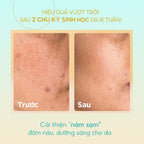 Tinh Chất Dưỡng Trắng Cấp Ẩm Làm Mờ Thâm Sạm Cho Bà Bầu GUO Radiance 4X Ampoule 30ml