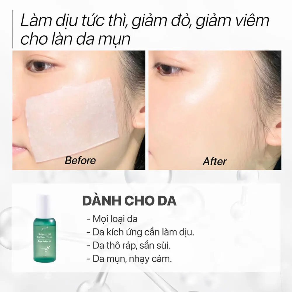 Kem Dưỡng Ẩm Phục Hồi Dành Cho Bà Bầu Chứa B5 Peptide Đồng GUO Calming Gel Cream